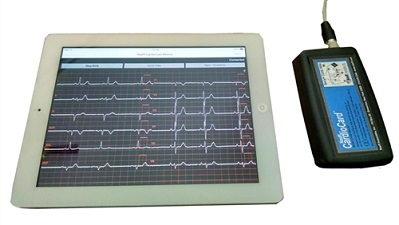 CardioCard Mobile ECG machine
